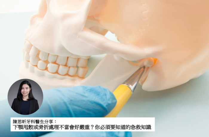 牙科迷思 下顎甩骹或骨折處理不當會好嚴重 你必須要知道的急救知識 親子王國